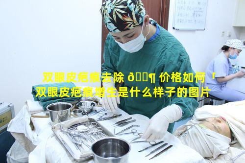 双眼皮疤痕去除 🐶 价格如何「双眼皮疤痕增生是什么样子的图片」